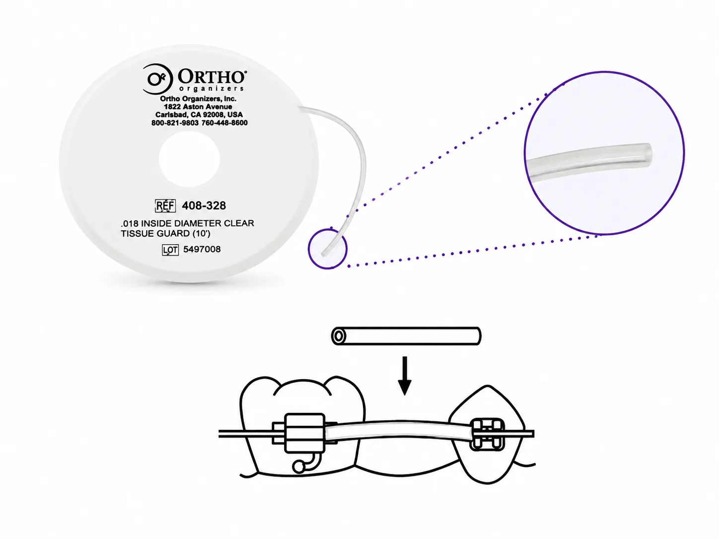Protector De Arco - ORTHO ORGANIZERS