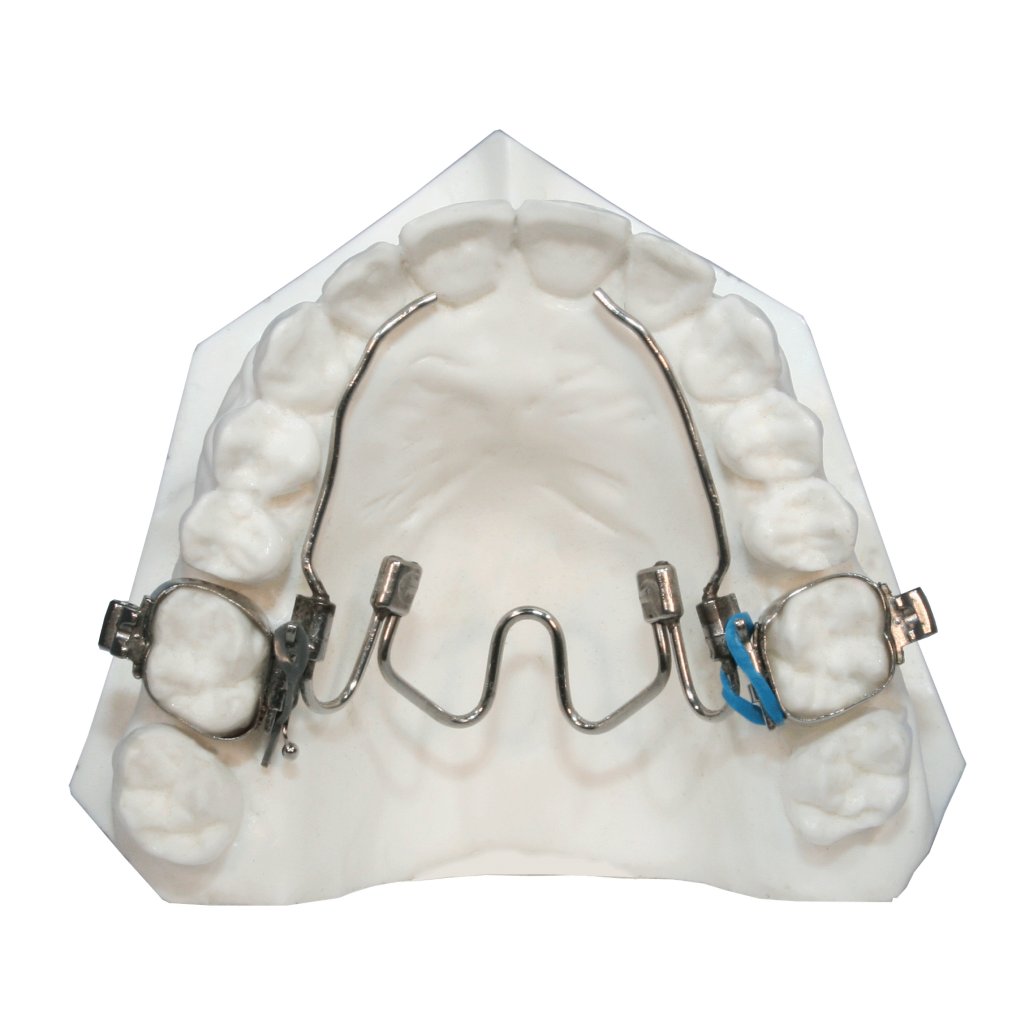 Expansor Palatino Niti - ORTHO ORGANIZERS
