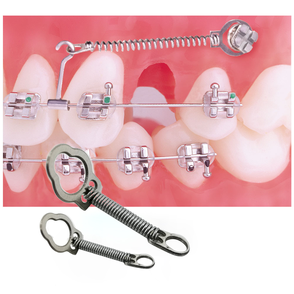 Resortes De Cierre Niti 010x030 200 gr - ORTHO ORGANIZERS